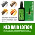 Neo Hair Lotion นีโอแฮร์โลชั่น ผลิตภัณฑ์สเปรย์ฉีดผม ปริมาณ 120 มล./ขวด  เราขายของใหม่และแท้เท่านั้น พร้อมส่ง