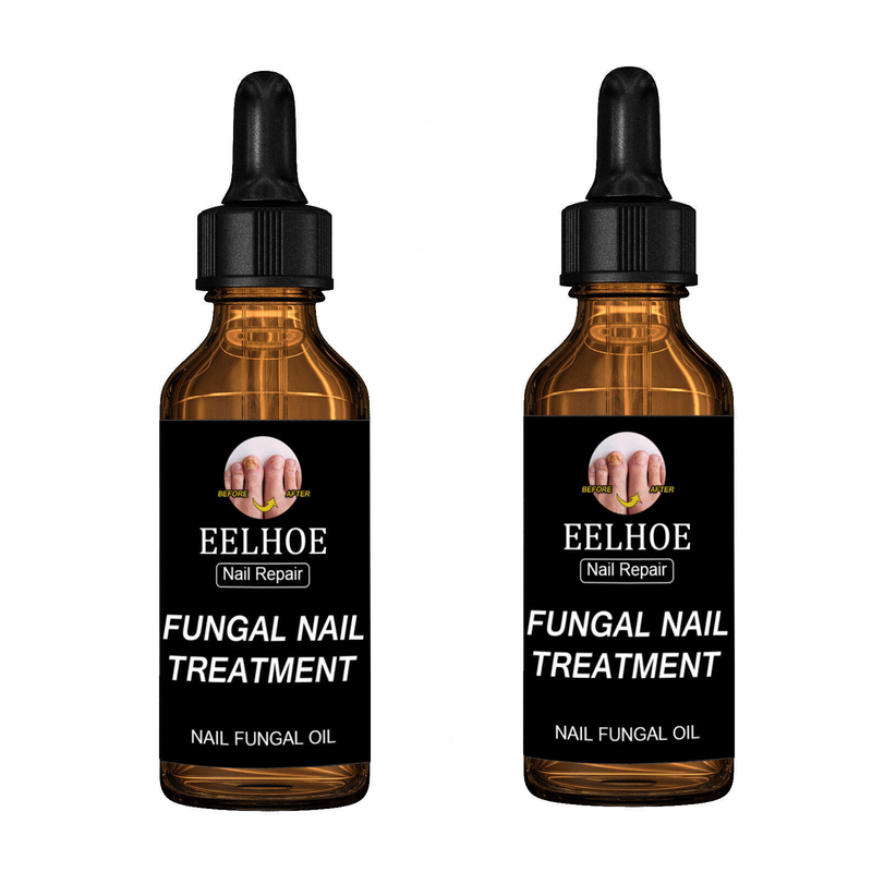 "Eelhoe บำรุงผิว  Nail Foot Toe Nail Fungus Removal  Gel Care Drop Fungal Treatment Repair Serum เล็บมือเล็บเท้าเปลี่ยนสีเล็บ 50ml ใช้ในการดูแลเล็บที่แตกหยาบกร้านเปลี่ยนสีลอกเล็บที่เกิดจากเชื้อราที่เล็บและส่งเสริมการเจริญเติบโตของเล็บให้แข็งแรง"