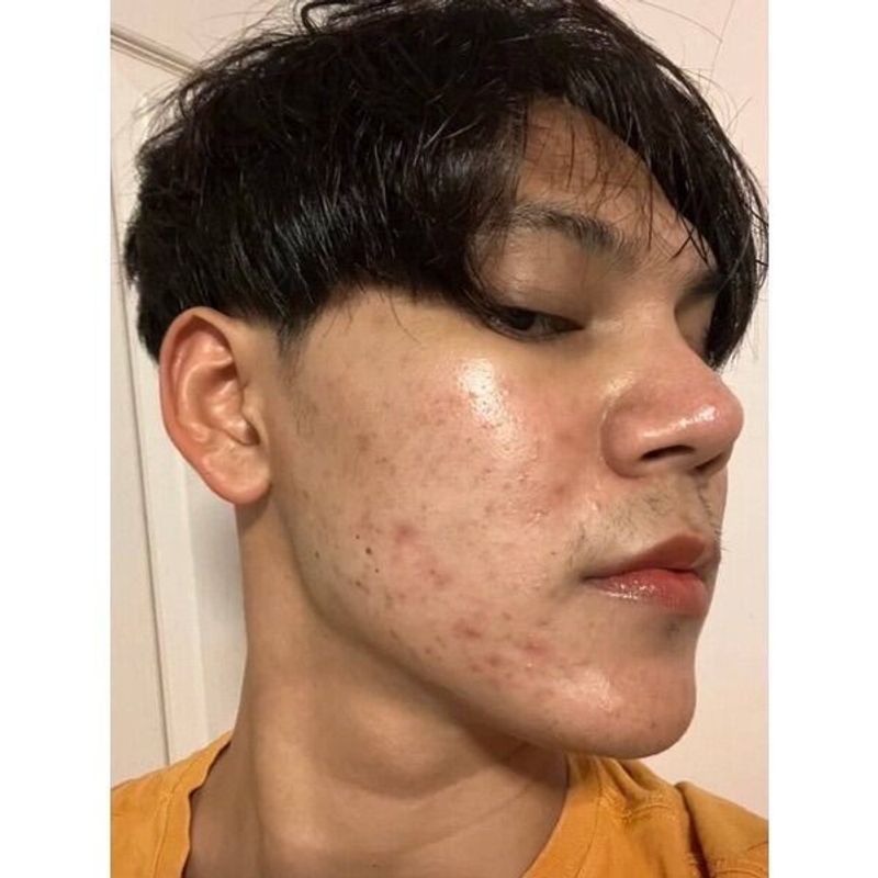 Good Skin:ครีมกิมจิ,ครีมกิมจิ 1 หลอด