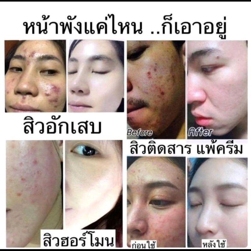 🔥ส่งฟรี 🚚กดคูปอง💵👇แท้!! 💯% จากเจ้าของแบรนด์   WinkFace ครีมหน้าวิ้งค์ (FaceWink) ครีมหน้าใส ครีมหน้าฉ่ำวาว