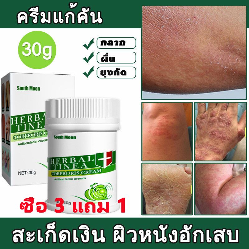 ซื้อ 3 แถม 1 South Moon พืชทรีทรี ยุงกัดสะเก็ดเงิน กลากเกลื้อน เพิ่มความชุ่มชื้น ผิวแห้ง 1หลอด 30g