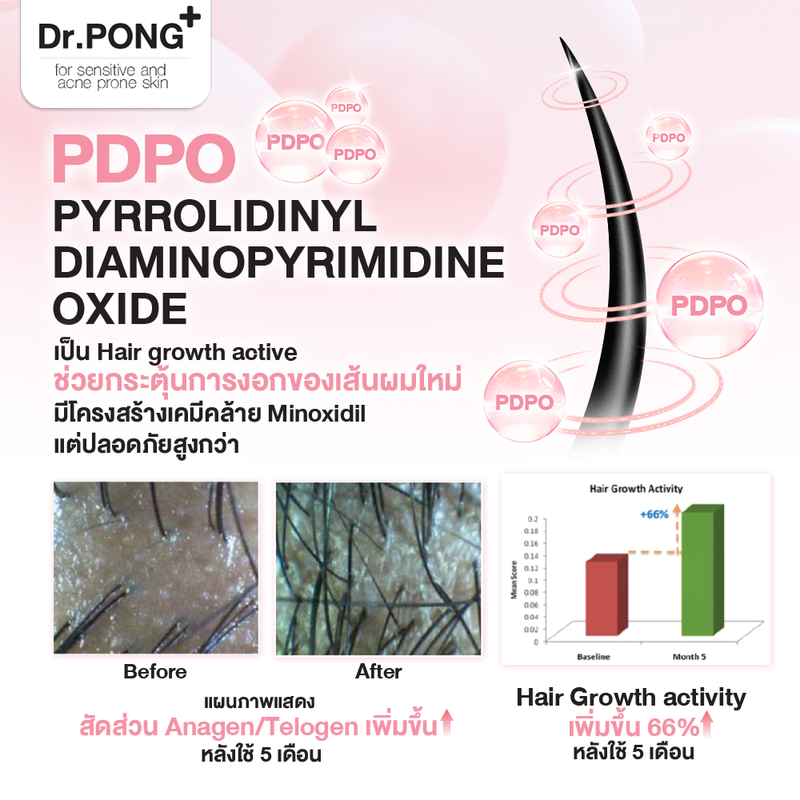 Dr.PONGแชมพูลดผมร่วง เพิ่มวอลุ่ม anti-hairloss shampoo - 2 in 1 shampoo x conditioner ปริมาณ 200 ml