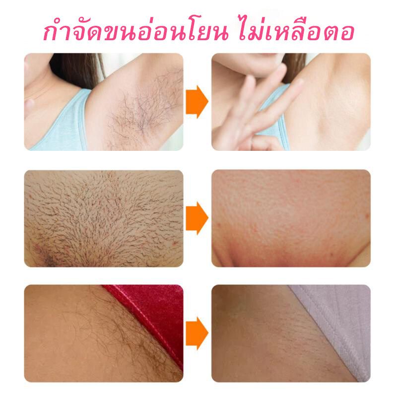 ครีมขจัดขนน้องสาว กำจัดขน แว็กขน กำจัดขนรักแร้ กำจัดขนที่ลับ อ่อนโยนต่อผิว ไม่เหลือตอ กำจัดขนจุดซ่อนเร้นถาวร น้องสาวเนียนใสไร้ขน 100ml