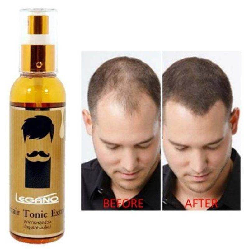 Legano Hair Tonic Extra : ลีกาโน่ แฮร์โทนิค เอ็กซ์ตร้า ลดการหลุดร่วง x 1 ชิ้น SRSi