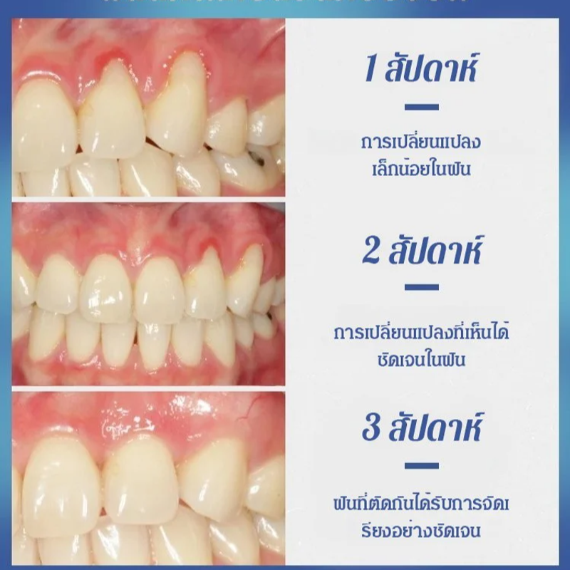 【จัดส่งจากประเทศไทย】เจลฟื้นฟูฟันรากฟัน ชุดดูแลช่องปาก ช่วยฟื้นฟูรูปร่างฟัน ฟื้นฟูฟันให้แน่นและสะอาด