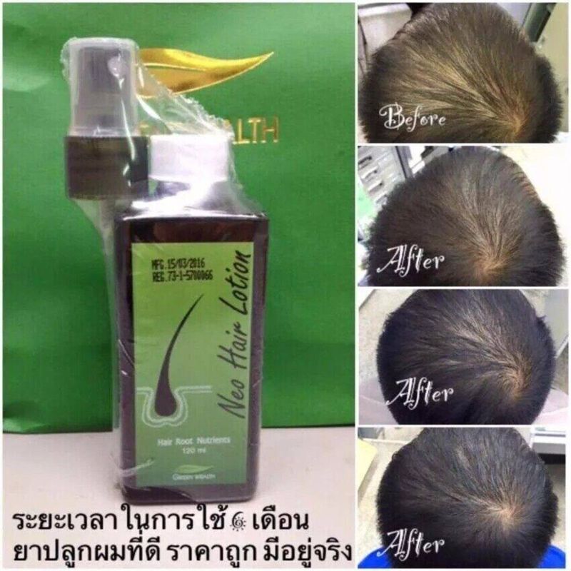 Neo Hair Lotion,3 ขวด 360ml