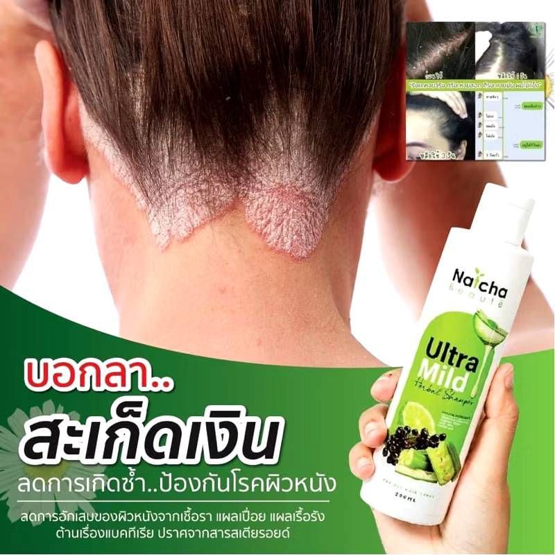 Natcha:Ultra U ครีม,ครีม 1 หลอด