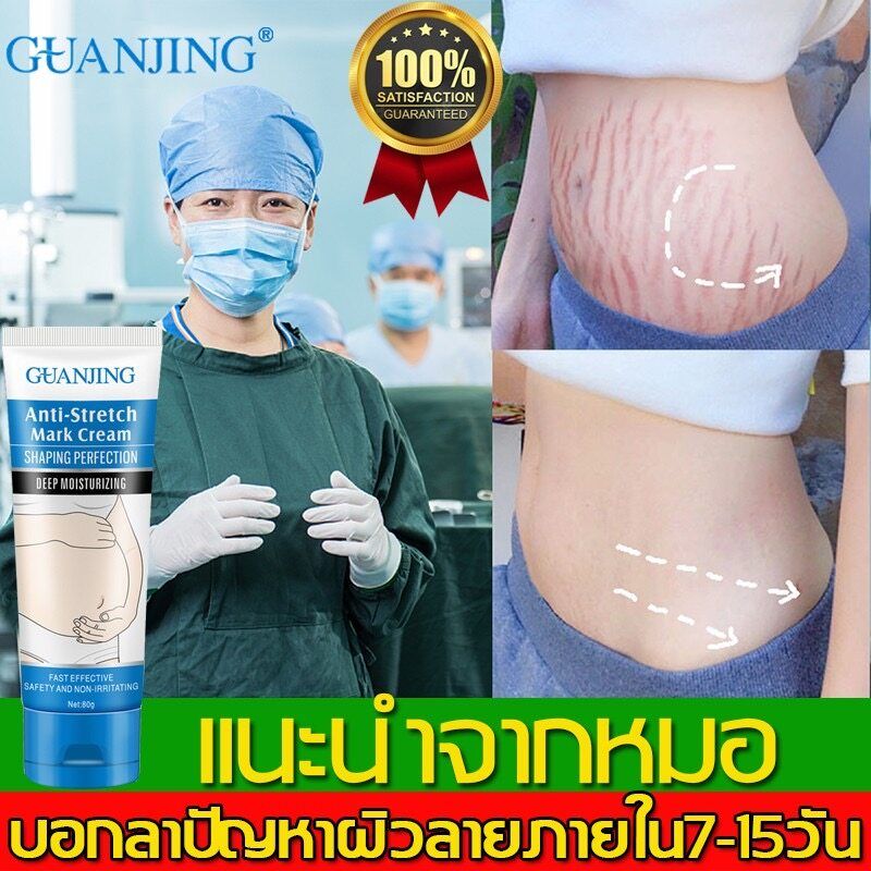 100%Guanjingครีมทาท้องลายแก้ท้องลาย ลดรอยแตกลาย ขาแตกลาย สะโพกลาย ผิวลาย รอยแตกลาย ครีมลดรอยแตกลาย ครีมทาท้องแตกลาย 80g L10