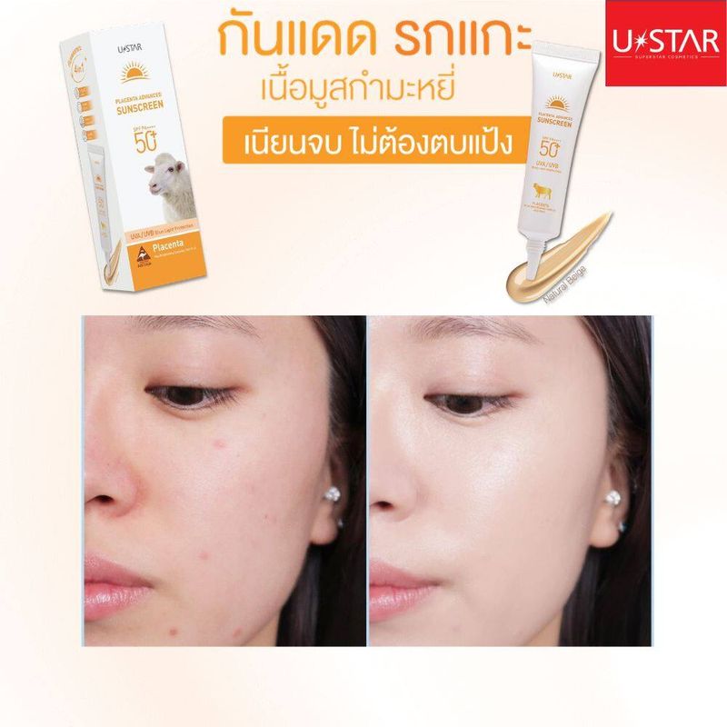 USTAR Placenta Advanced Sunscreen SPF 50+PA++++ ยูสตาร์ พลาเซนต้า แอดวานซ์ ซันสกรีน (กันแดดรกแกะ)