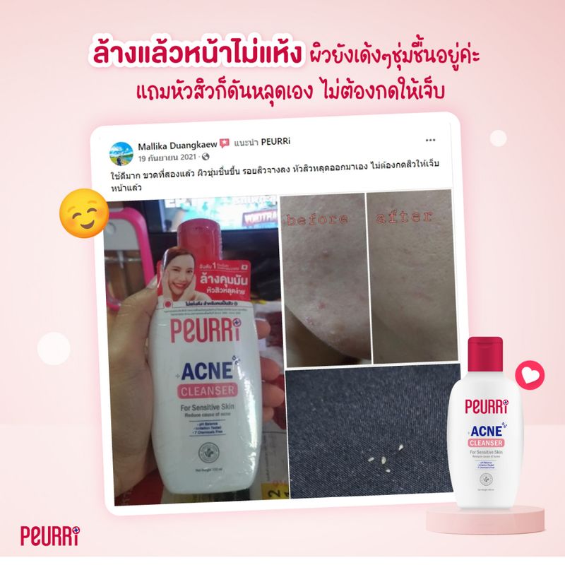 PEURRi:Acne Cleanser250ml + Anti Gel Acne8g + Dragon's Blood Scar Gel 8g,{"propIds":"","propNames":""}