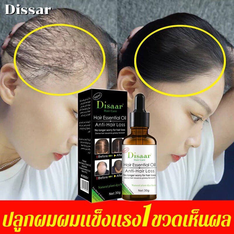 Disaar เซรั่มปลูกผม น้ำยาปลูกผม30g ฟื้นฟูผม ป้องกันผมร่วง เซรั่มบำรุงผม  รักษาผม ลดผมร่วง หยุดผมร่วง