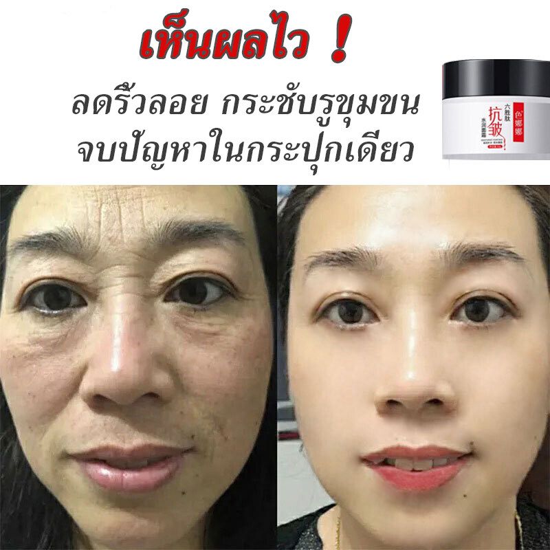 【ซื้อ 3 แถมฟรีเซรั่ม 2 ขวด】ครีมริ้วรอย ทารอยตีนกา ริ้วรอยหน้าผาก ลดความหมองคล้ำ กระชับผิวหน้า ครีมหน้าใส  ให้ความชุ่มชื้น ให้ผิวเนียนนุ่มกระชับ