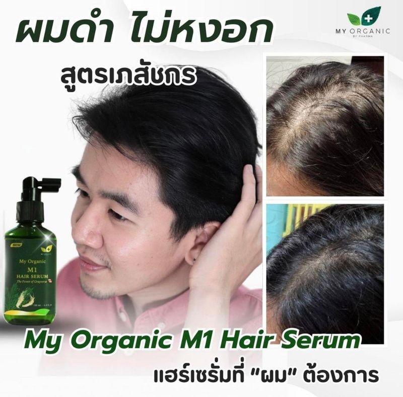 [พร้อมส่ง] My Organic Hair Tonic แก้ผม หงอก ผมร่วง ผมบาง ปิดผมขาว เซรั่ม บำรุงผม มายออร์แกนิค ดูแลผม ดกดำ เซรัมปลูกผม น้ํายาปลูกผมชาย เซรั่มแก้ ผมงอก