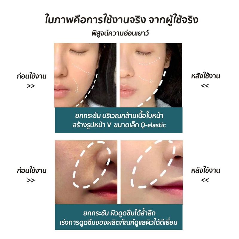 iMI เครื่องนวดหน้า อัลตร้าโซนิค ผลักครีม ลดริ้วรอย จุดด่างดำ รอยดำ กระชับใบหน้า Golden Face Massage Beauty