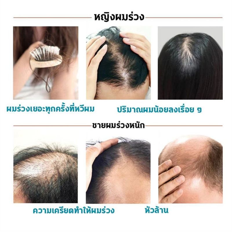 แชมพูเร่งผมยาว แชมพูแก้ผมหงอก แชมพู ป้องกัน ร่วง แชมพูขจัดรังแค แ 300MLแชมพูขิง แชมพูแก้ผมร่วง แชมพูสมุนไพร แชมพูชายหญิง