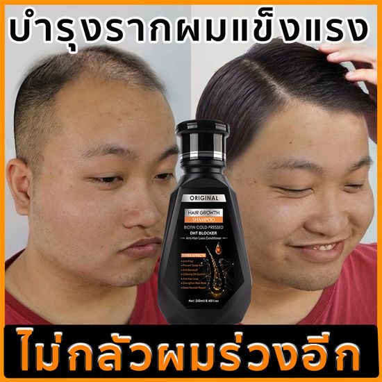 【มีสินค้าพร้อมจัดส่ง】PEIMEI แชมพูสมุนไพร แชมพูแก้ผมร่วง แชมพูขิง 250ml สูตรเข้มข้นพิเศษ สกัดจากขิงสด ซ่อมแซมผมเสีย（เร่งผมเกิดใหม่ ยาสระผมเร่งยาว ป้องกันผมล่วง แชมพูขิงเพียว แชมพูสระผม แชมพูสระผมตรง แชมพูเร่งผมยาว แชมพูลดผมร่วง แชมพูขจัดรังแค）