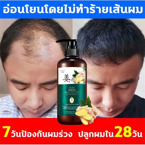 แชมพูเร่งผมยาว แชมพูแก้ผมหงอก แชมพู ป้องกัน ร่วง แชมพูขจัดรังแค แ 300MLแชมพูขิง แชมพูแก้ผมร่วง แชมพูสมุนไพร แชมพูชายหญิง