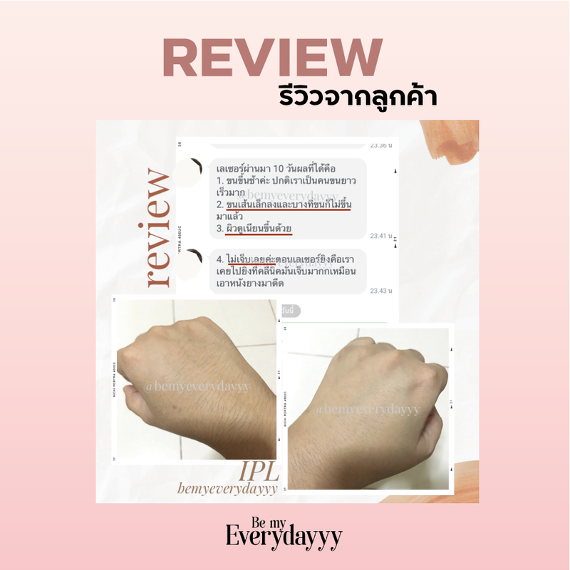 BEMYEVERYDAYYY//EVD02 โปรCOMBO : เครื่องเลเซอร์กำจัดขนถาวร (SFPL™) ของแท้จากEVD รับประกัน1ปี กำจัดขนถาวร รุ่นใหม่ บอกลาการ โกนขน แว๊กซ์