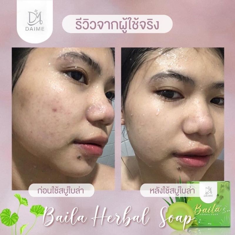 สบู่ไบล่า baila soap ตัวดังในติ้คต้อค ก้อนใหญ่มากใช้คุ้ม(1 กล่องก้อนใหญ่)