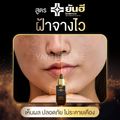 ยันฮี:ANTI MELASMA SERUM,1 ขวด แถม สบู่ 1,Free Shipping