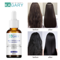 KAGARY Multi-Peptide Serum Anti Hair Loss Hair Serum 30 ml เซรั่มบำรุงผม น้ำมันใส่ผม ออยล์บำรุงผม บำรุงผม ทรีทเมนต์สำหรับเส้นผม