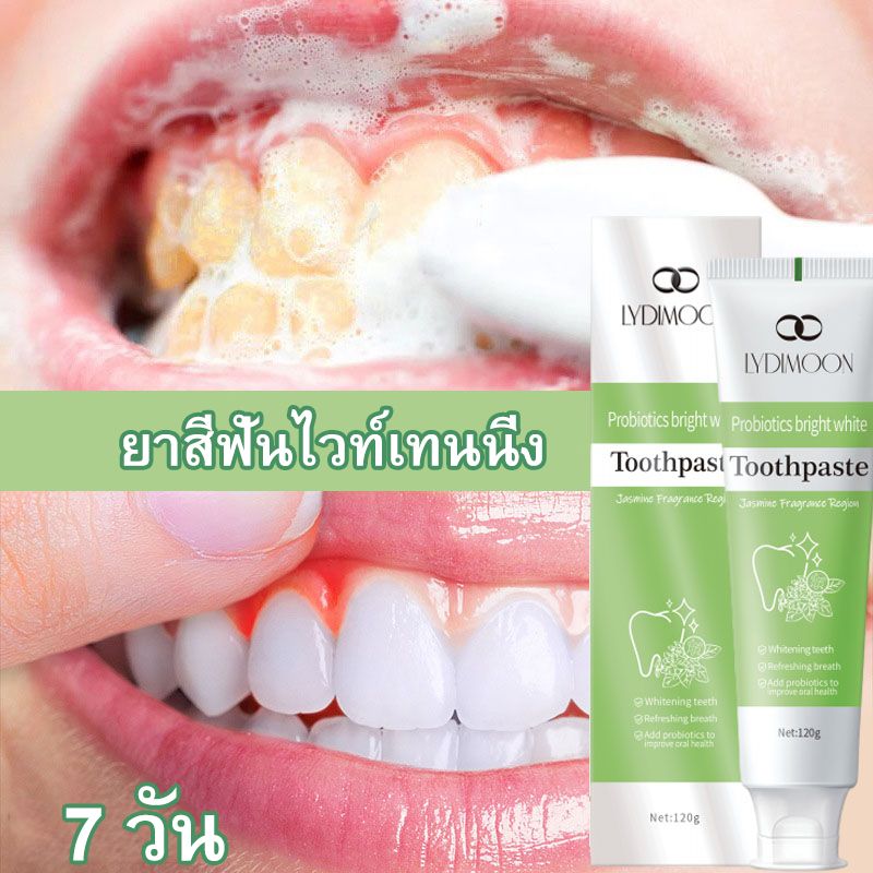 ยาสีฟันไวท์เทนนิ่ง ยาสีฟันโปรไบโอติก ยาสีฟันขจัดหินปูน  120g ขจัดคราบเหลือง ฟอกฟันขาวขจัดคราบหินปูน ฟอกฟันขาว ดูแลเหงือก