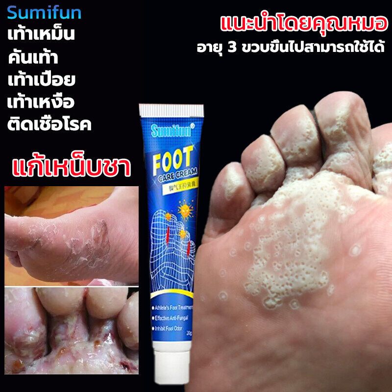 【ซื้อ2แถม1】 ครีมระงับกลิ่นเท้า ที่มีประสิทธิภาพ100% ครีมรักษาเชื้อราที่เท้า ถอดเท้าของนักกีฬา การดูแลเท้า รักษาเท้า ต้านเชื้อแบคทีเรีย ดูแลเท้าระงับเหงื่อและกลิ่นเท้า ครีมลดกลิ่นเท้า ครีมทาเท้า ช่วยบรรเทาปัญหาเท้าลอกและมีกลิ่นได้อย่างรวดเร็ว