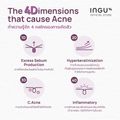 Ingu:4D-Acne Clearing Toner,50ml