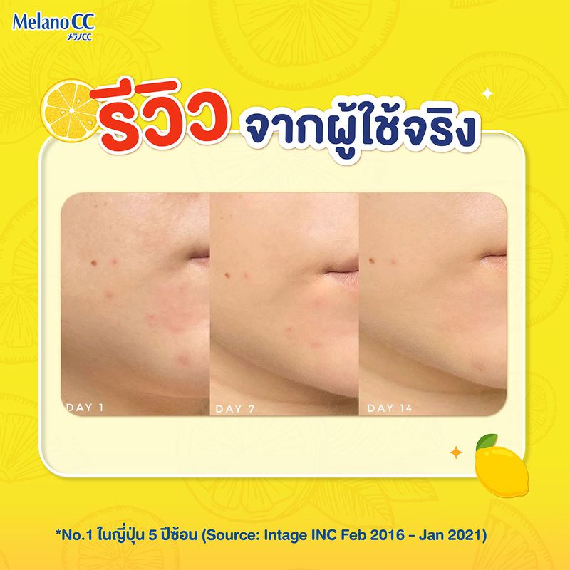 [1แถม1] Melano CC Vitamin C Brightening Essence 20ml. เมลาโน ซีซี วิตามินซี ไบรท์เทนนิ่ง เอสเซ้นส์ 20มล