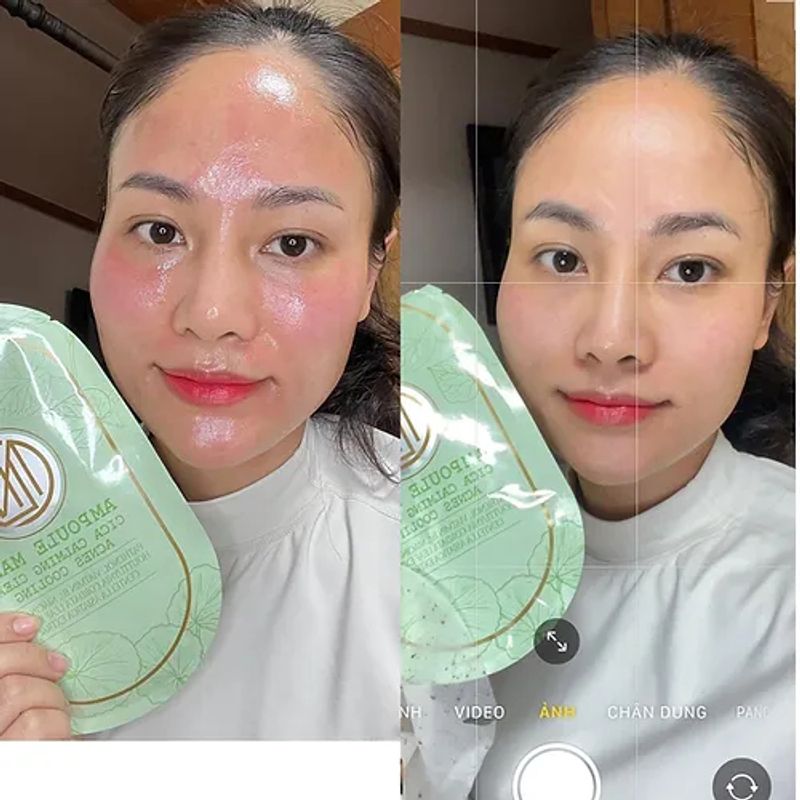 (🌼แท้ / พร้อมส่ง 🌼) Nil Ampoule Mask  สีเขียว ยกกล่อง 10 แผ่น