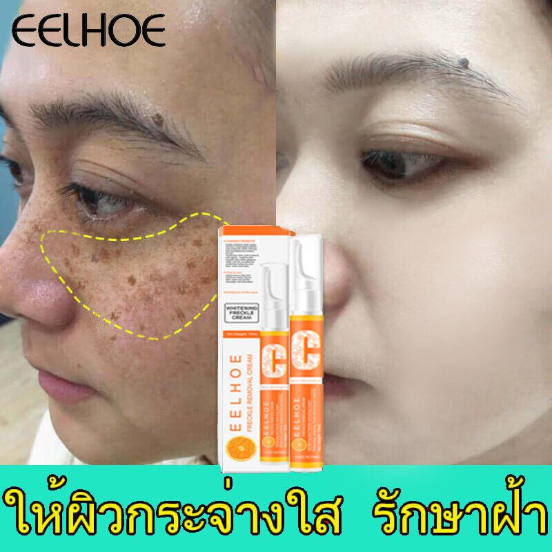 ครีมแก้ฝ้าแท้ๆ eelhoe ทาฝ้าของแท้ ครีมทาฝ้าหนาๆๆ ครีม แก้ ฝ้า กระ ครีมกำจัดฝ้า vitamin c อุดมไปด้วยวิตามินรวมและอาร์บูติน ให้ความชุ่มชื้น ขาวใส ลดเลือนจุดด่างดำ Freckle Cream