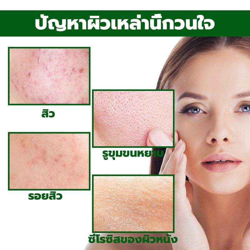 Jayusing 30ml ครีมแต้มสิว ลดสิวอุดตัน ละลายหัวสิว ช่วยลดรอยสิว ไม่อุดตันผิว รูขุมขนกระชับ ครีมลดรอยสิว เจลแต้มสิว เซรั่มลดสิว