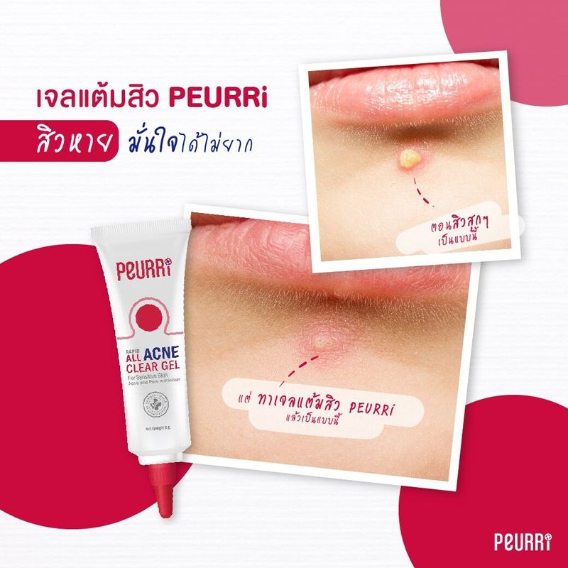 เจลแต้มสิว Peurri All Acne Clear Gel เพียวรี แรพิท ออล แอคเน่ เคลียร์ เจล [8 g.]