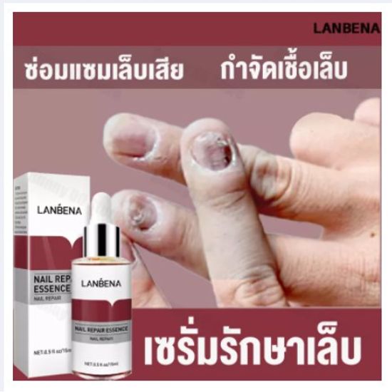 ของแท้ 100% LANBENA เซรั่มบำรุงเล็บ น้ำยาบำรุงเล็บ 15ml บำรุงเล็บ ต่อต้านการติตเชื้อรา ซ่อมแซมเล็บแตก เล็บเปราะ เล็บหนา