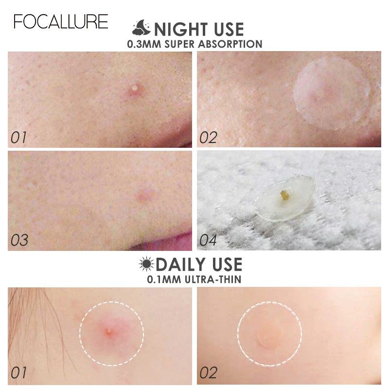 Focallure แผ่นแปะสิว ควบคุมความมัน กันน้ำ