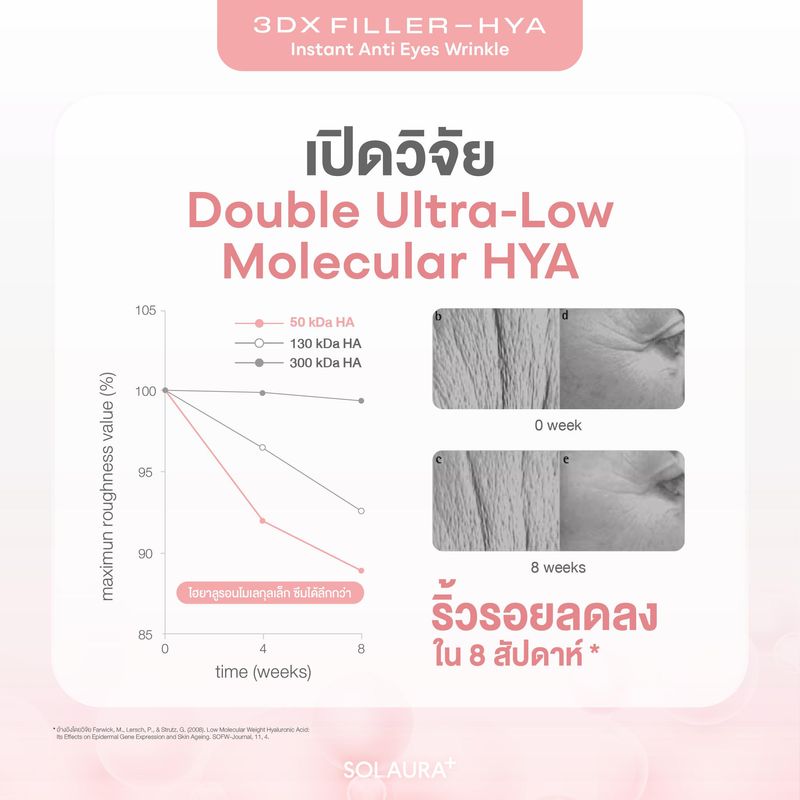 SOLAURA 3Dx Filler-HYA Instant Anti Eyes Wrinkle