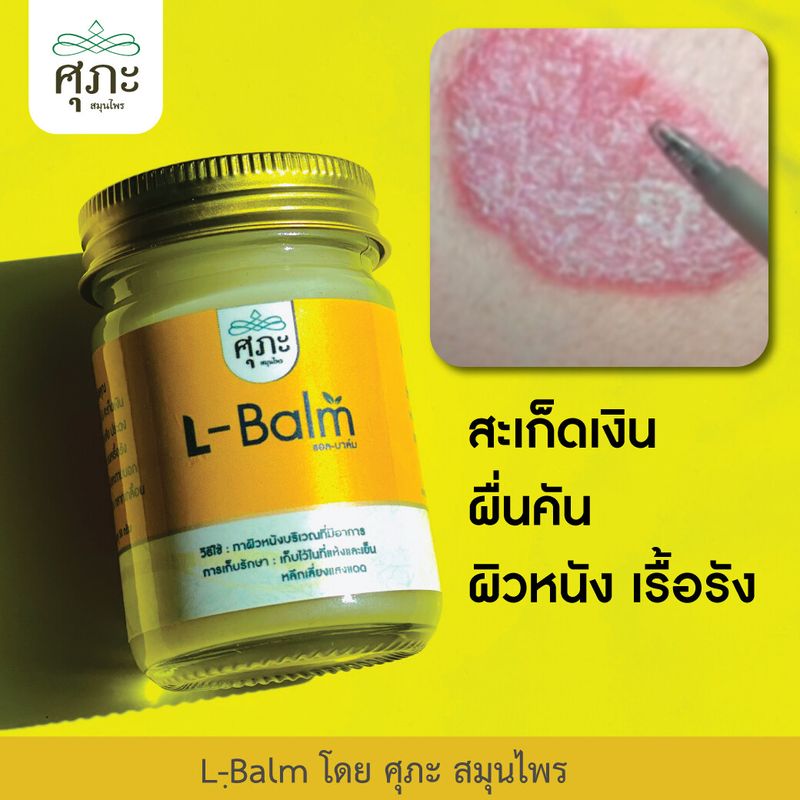 L-care รักษาสะเก็ดเงิน ภูมิแพ้ ต่อมน้ำเหลืองเสีย - ศุภะ สมุนไพร