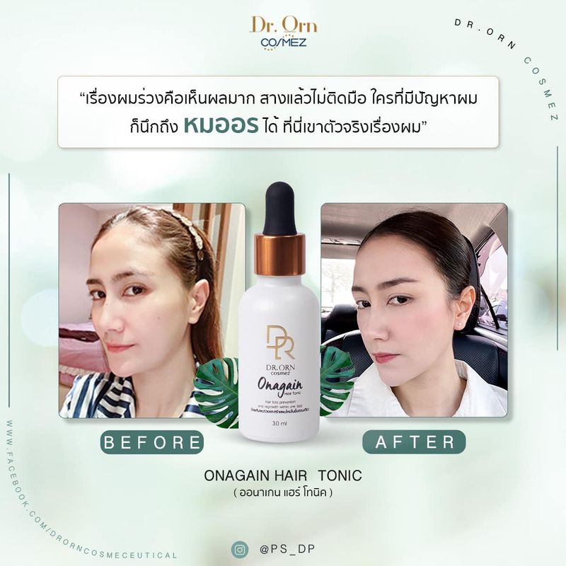 Onagain Hair Serum เซรั่มสำหรับคนผมร่วง ยืดอายุเส้นผมให้หลุดร่วงน้อยลง