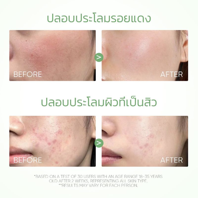 SKINTIFIC  ANCE CLAY MUSK COLLCTION ลดสิว ลดรอยสิว ลอกสิวเสี้ยน สิว ลดรอยแดง มาส์กโคลน ลดรอยแดงจากสิว (MUGWORt/ VOLCANO)