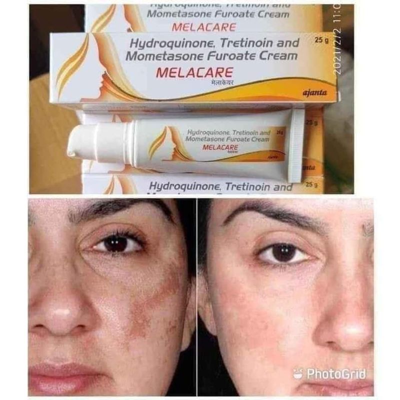 Melacrae cream