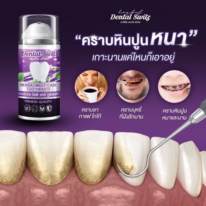 (ซื้อ 1 แถม 1 + แถมรางฟัน 2 ชิ้น) เจลฟอกฟันขาว เจลฟอกฟันเดนทัล เดนทัลสวิตซ์ Dental Switz