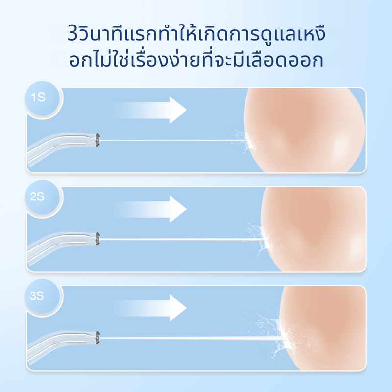 Mornwell F32 Water Flosser หมขัดฟันพลังน้ำ อัลตราซาวนด์ (สีดำ/สีขาว)แสดงหน้าจออัจฉริยะ