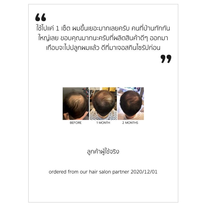 ABRACADABRA Anti-Hair fall shampoo แชมพูลดผมร่วง ช่วยผมเกิดใหม่ +214% ด้วยสูตรลับสมุนไพรจีน