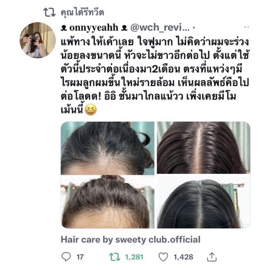 Mini Set DT(Detox) หนังศรีษะมัน+เคราตินแฮร์เซรั่ม ผมร่วง-ผมบาง สูตร2 [แชมพู+ออยล์+เคราตินแฮร์เซรั่ม]