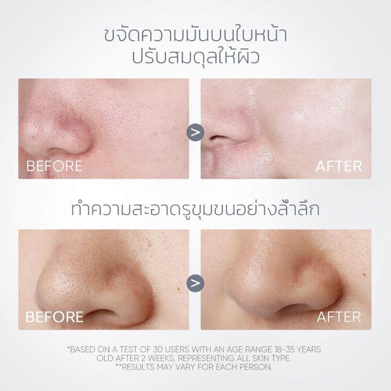 SKINTIFIC โวลคาโน ดีพ พอร์ คลีนซิ่ง เคลย์สติ๊ก (ทำความสะอาดสิวหัวดำและสิวเสี้ยน) Alaska Volcano Clay Mask Stick