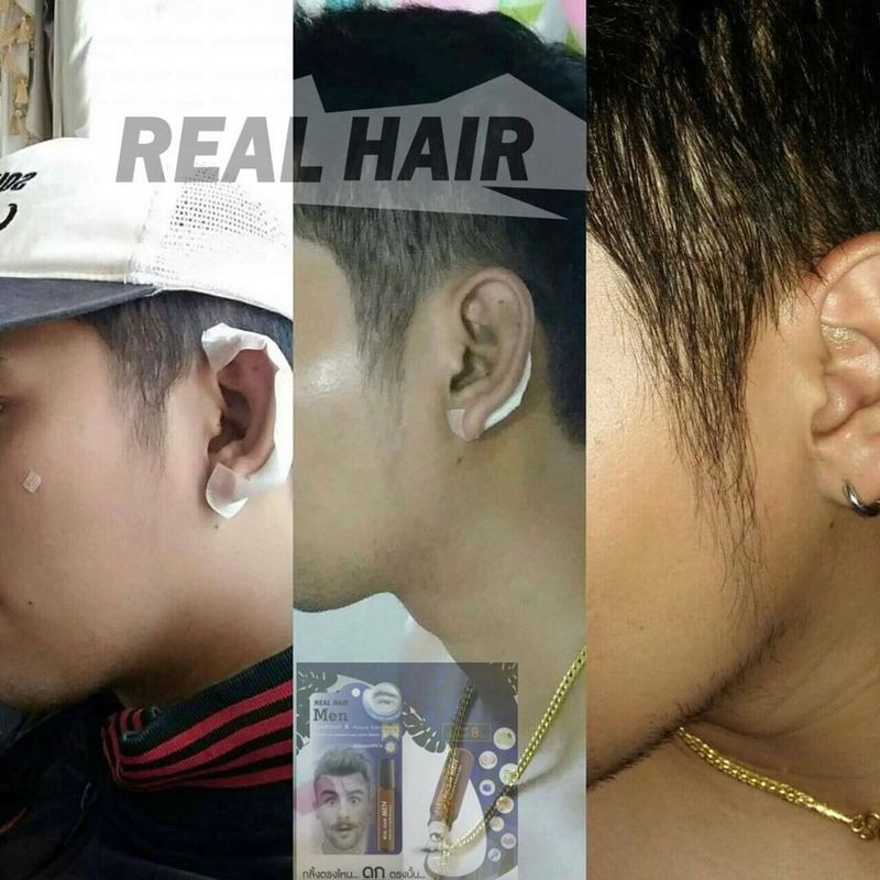 Real Hair- เซรั่มปลูกผม คิ้ว หนวด จอน -(สูตรหัวเชื้อ) ใช้ได้ทั้ง ช ญ