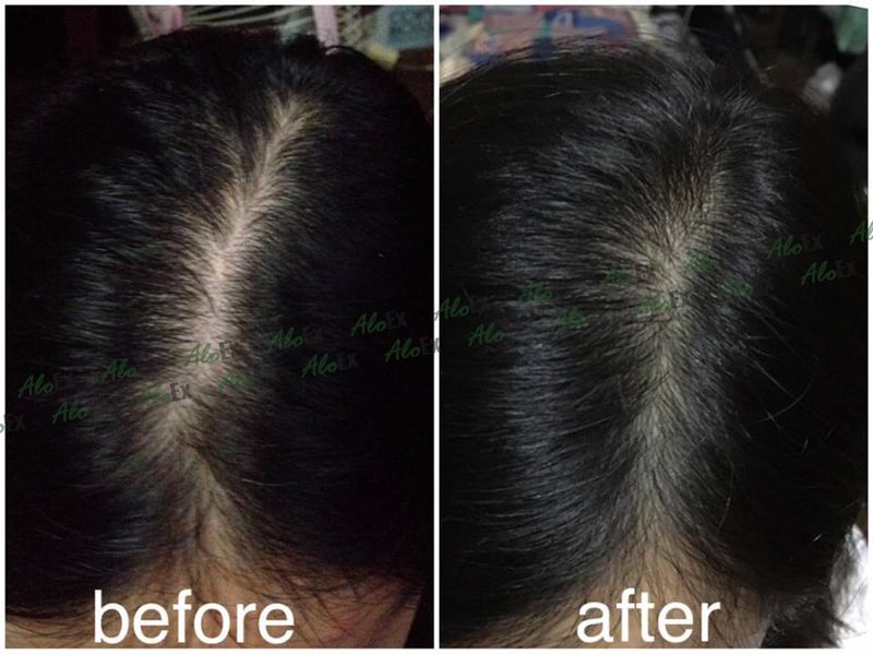 AloEx Black Shampoo 1 ขวดและ AloEx Hair Mask 1 หลอด เซตแชมพูและทรีทเม้นท์บำรุงเส้นผม ลดผมขาดร่วง สำหรับผมแห้งเสีย-ผมทำสี