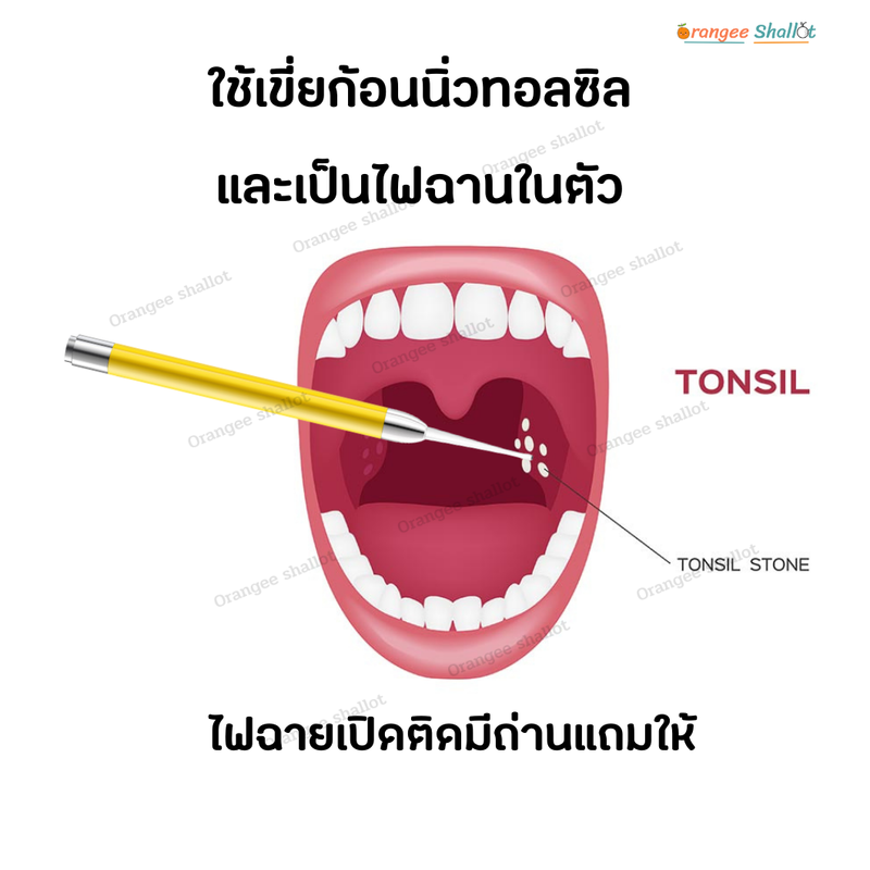 ส่งไว อุปกรณ์กำจัดนิ่วทอนซิล นิ่วทอมซิน สาเหตุกลิ่นปากเหม็นนิ่วทอลซิน  กลิ่นปากแรง ไซริ้งฉีดฟันคุด ไซริ้งปลายโค้ง กำจัดกลิ่นปาก Orangee