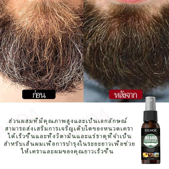 EELHOE( ของแท้จากบริษัท )เซรั่มปลูกคิ้วน้ำยาปลูกคิ้วน้ำยาปลูกหนวดน้ำยาเร่งผมยาว เซรั่มปลูกหนวดน้ำยาปลูกผมยาปลูกคิ้วดกเร่งผมยาว เซรั่มปลูกเครา เซรั่มปลูกคิ้ว เหมาะสำหรับผู้ที่มีพันธุกรรมผมน้อยและมีความนับถือตนเองต่ำ ผู้พันหนวด