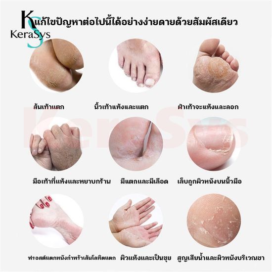 KeraSys ครีมทามือบิวตี้พริ้นท์ 30กรัม มอยส์เจอร์ไรซิ่ง ครีมทามือบำรุงผิวอ่อน ๆ บำรุงผิวให้ความชุ่มชื้น ครีมทามือไวท์เทนนิ่ง